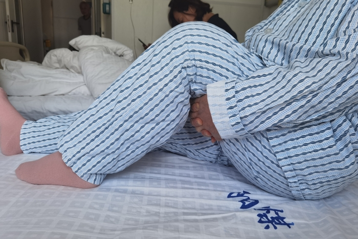 术后3日 术后3日